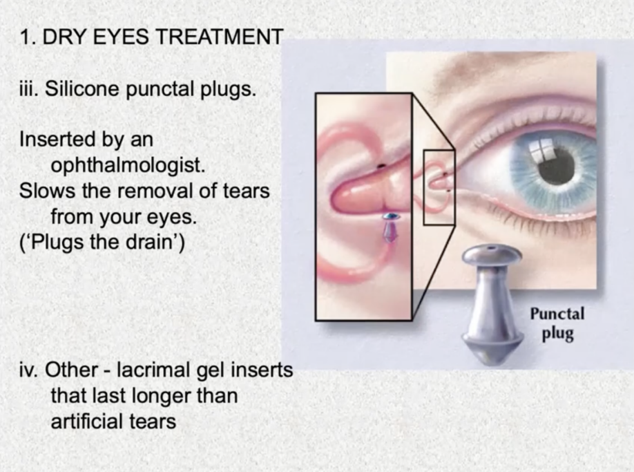 Dry Eye Treatment Diagram