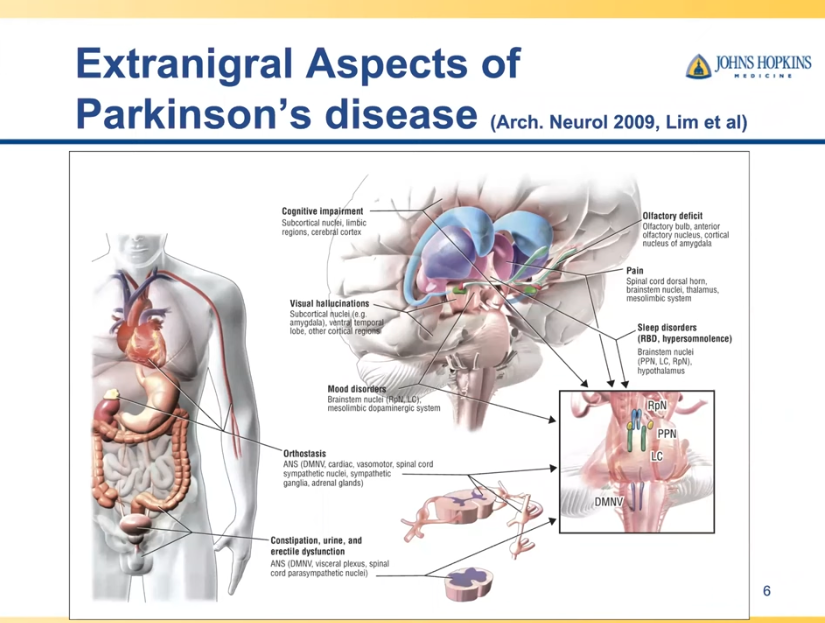 Graphic from Dr. Greg Pontone's presentation