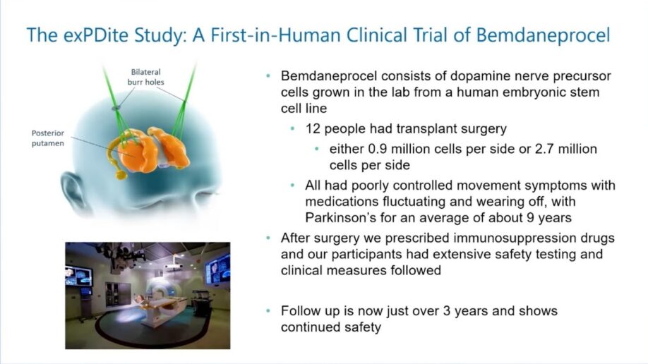 Diagram of brain showing bilateral surgery targeting posterior putamen, plus operating room photo; text describes exPDite study details including 12 patients, cell doses, and three-year safety follow-up