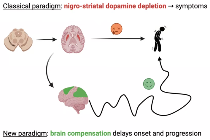Diagram comparing two models of Parkinson's disease: the classical dopamine-depletion model leading directly to symptoms, and a new model showing brain compensation delaying onset and progression.
