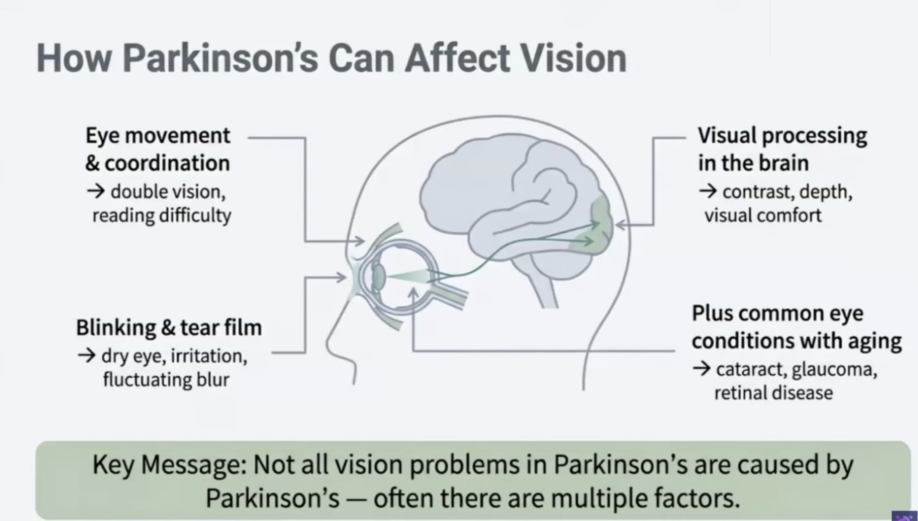How Parkinson's Can Affect Vision